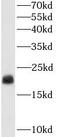 Transgelin antibody, FNab08935, FineTest, Western Blot image 