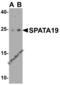 Spermatogenesis Associated 19 antibody, 6617, ProSci, Western Blot image 