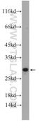 Coiled-Coil Domain Containing 85B antibody, 18282-1-AP, Proteintech Group, Western Blot image 
