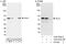 ETS Transcription Factor ELK1 antibody, A303-530A, Bethyl Labs, Immunoprecipitation image 