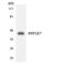 Protein Phosphatase 1 Regulatory Subunit 7 antibody, LS-C200513, Lifespan Biosciences, Western Blot image 