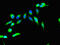 Ribosomal Protein S6 Kinase A4 antibody, CSB-PA020467LA01HU, Cusabio, Immunofluorescence image 