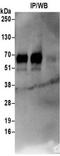 Neutral amino acid transporter B(0) antibody, NBP2-32238, Novus Biologicals, Immunoprecipitation image 