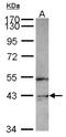 Phosphatidylinositol-5-Phosphate 4-Kinase Type 2 Gamma antibody, NBP2-19836, Novus Biologicals, Western Blot image 
