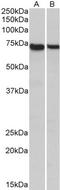 Syntaxin Binding Protein 3 antibody, TA329670, Origene, Western Blot image 