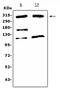 Mediator Complex Subunit 13 antibody, A04545-1, Boster Biological Technology, Western Blot image 