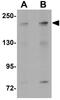 Anaphase-promoting complex subunit 1 antibody, GTX31801, GeneTex, Western Blot image 