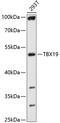 T-Box 19 antibody, 13-678, ProSci, Western Blot image 
