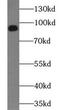 Neurotrophic Receptor Tyrosine Kinase 2 antibody, FNab09002, FineTest, Western Blot image 