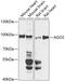 Argonaute RISC Catalytic Component 2 antibody, 19-980, ProSci, Western Blot image 