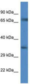 Sodium- and chloride-dependent glycine transporter 1 antibody, TA346444, Origene, Western Blot image 