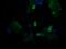 TAP Binding Protein Like antibody, MA5-26155, Invitrogen Antibodies, Immunocytochemistry image 