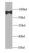 hPc2 antibody, FNab01331, FineTest, Western Blot image 