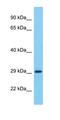 Cancer/Testis Antigen Family 47 Member A9 antibody, orb327164, Biorbyt, Western Blot image 
