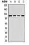 ETS2 Repressor Factor antibody, LS-C358748, Lifespan Biosciences, Western Blot image 