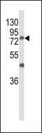 Polypeptide N-acetylgalactosaminyltransferase 3 antibody, GTX80494, GeneTex, Western Blot image 