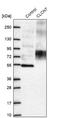 Chloride Voltage-Gated Channel 7 antibody, NBP1-91791, Novus Biologicals, Western Blot image 