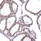 MAK16 Homolog antibody, PA5-60704, Invitrogen Antibodies, Immunohistochemistry paraffin image 