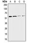 Cholinergic Receptor Nicotinic Alpha 3 Subunit antibody, LS-C352003, Lifespan Biosciences, Western Blot image 