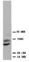 Placenta growth factor antibody, PA1066, Boster Biological Technology, Western Blot image 