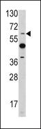 ETS Variant 4 antibody, PA5-13595, Invitrogen Antibodies, Western Blot image 