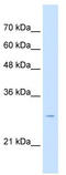 Tetraspanin 32 antibody, TA339018, Origene, Western Blot image 
