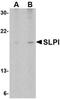 Secretory Leukocyte Peptidase Inhibitor antibody, NBP1-76803, Novus Biologicals, Western Blot image 