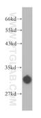 Carbonic Anhydrase 5B antibody, 13342-1-AP, Proteintech Group, Western Blot image 
