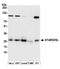 STARD3 N-Terminal Like antibody, A305-519A, Bethyl Labs, Western Blot image 
