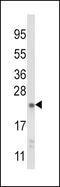 N-Ribosyldihydronicotinamide:Quinone Reductase 2 antibody, 63-550, ProSci, Western Blot image 