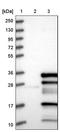 Aurora kinase A-interacting protein antibody, PA5-56869, Invitrogen Antibodies, Western Blot image 