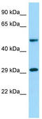 O-Sialoglycoprotein Endopeptidase Like 1 antibody, TA331775, Origene, Western Blot image 