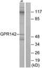 G Protein-Coupled Receptor 142 antibody, TA316387, Origene, Western Blot image 
