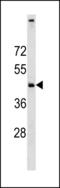 Chromosome 11 Open Reading Frame 24 antibody, LS-C203786, Lifespan Biosciences, Western Blot image 