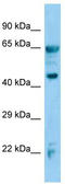 Alcohol Dehydrogenase 7 (Class IV), Mu Or Sigma Polypeptide antibody, TA346215, Origene, Western Blot image 