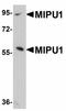 Zinc finger protein 667 antibody, LS-C108522, Lifespan Biosciences, Western Blot image 