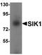 Msk antibody, orb95660, Biorbyt, Western Blot image 
