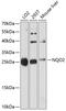 N-Ribosyldihydronicotinamide:Quinone Reductase 2 antibody, 14-126, ProSci, Western Blot image 