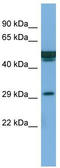 Protein FAM3B antibody, TA338952, Origene, Western Blot image 