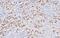 Nanog Homeobox antibody, NBP1-04320, Novus Biologicals, Immunohistochemistry paraffin image 