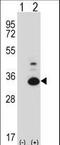 TP53 Regulating Kinase antibody, LS-C164591, Lifespan Biosciences, Western Blot image 