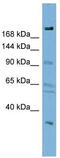Disco-interacting protein 2 homolog A antibody, TA338932, Origene, Western Blot image 