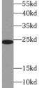 Glutathione Peroxidase 8 (Putative) antibody, FNab03625, FineTest, Western Blot image 