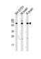 Dihydropyrimidinase Like 5 antibody, M08644, Boster Biological Technology, Western Blot image 
