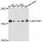 Late Endosomal/Lysosomal Adaptor, MAPK And MTOR Activator 1 antibody, A11619, ABclonal Technology, Western Blot image 