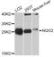 N-Ribosyldihydronicotinamide:Quinone Reductase 2 antibody, A11746, ABclonal Technology, Western Blot image 