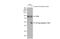 CD44 antibody, GTX102111, GeneTex, Western Blot image 