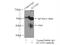 Potassium Voltage-Gated Channel Subfamily J Member 10 antibody, 12503-1-AP, Proteintech Group, Immunoprecipitation image 