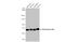 Nuclear pore glycoprotein p62 antibody, GTX636570, GeneTex, Western Blot image 