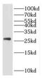 Potassium Channel Tetramerization Domain Containing 5 antibody, FNab04506, FineTest, Western Blot image 